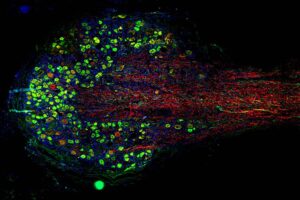 human dorsal root ganglion