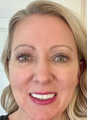 Kimberly Abeln, CRNA