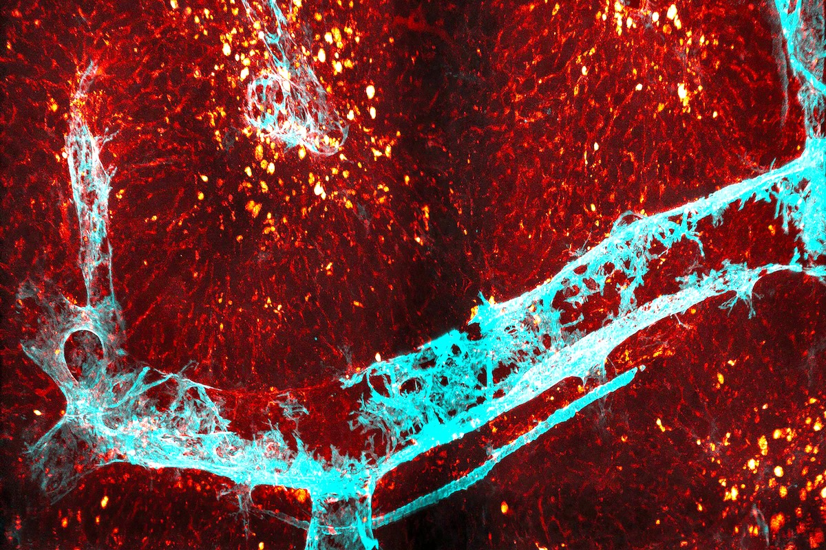 New compound stops common complications after intestinal surgery